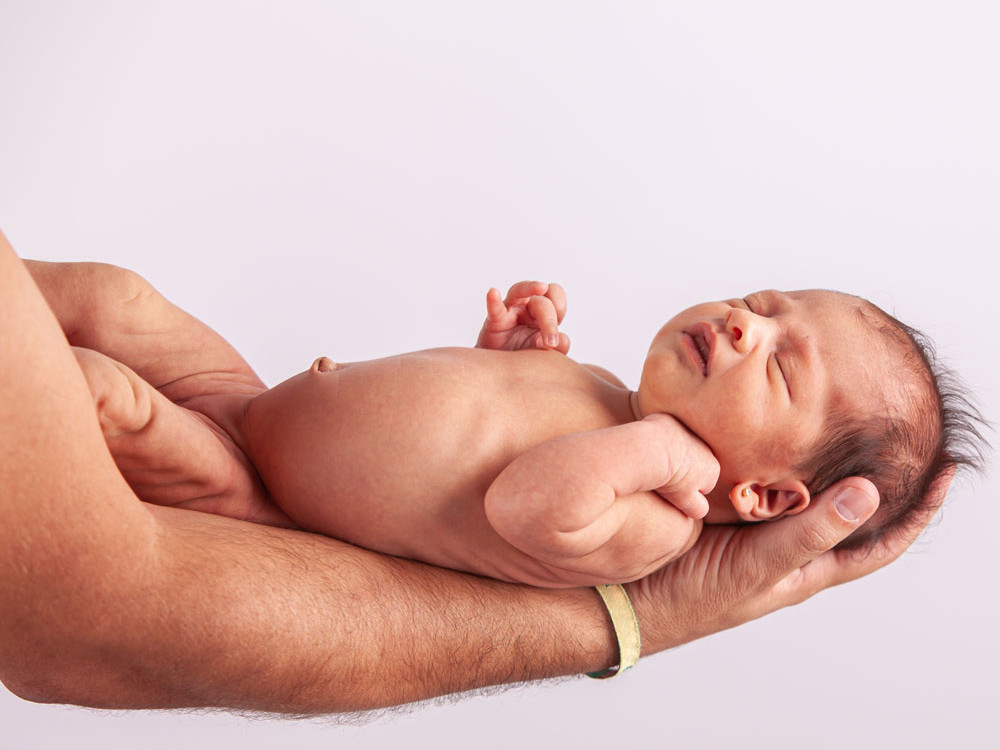Qué es el granuloma umbilical en el bebé